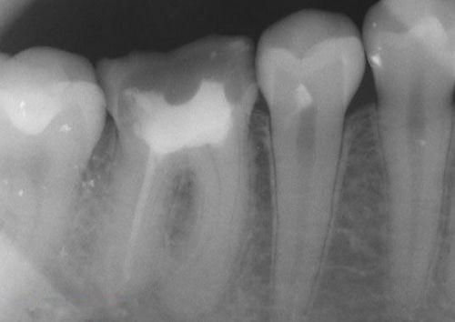 中國再生牙齒研究新進(jìn)展，重塑微笑，科技引領(lǐng)牙齒再生新篇章