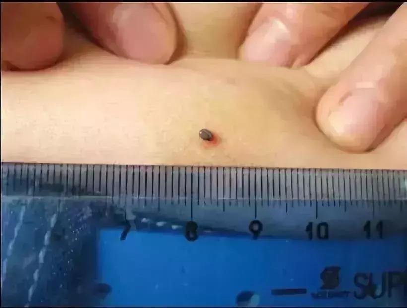 小明快樂疫情日志，最新疫情發(fā)布與日常觀察